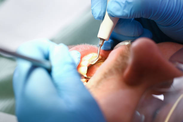 Best Emergency Denture Repair in Midway, KY