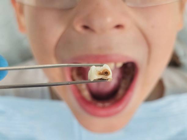 Best Pediatric Emergency Dentist in Midway, KY